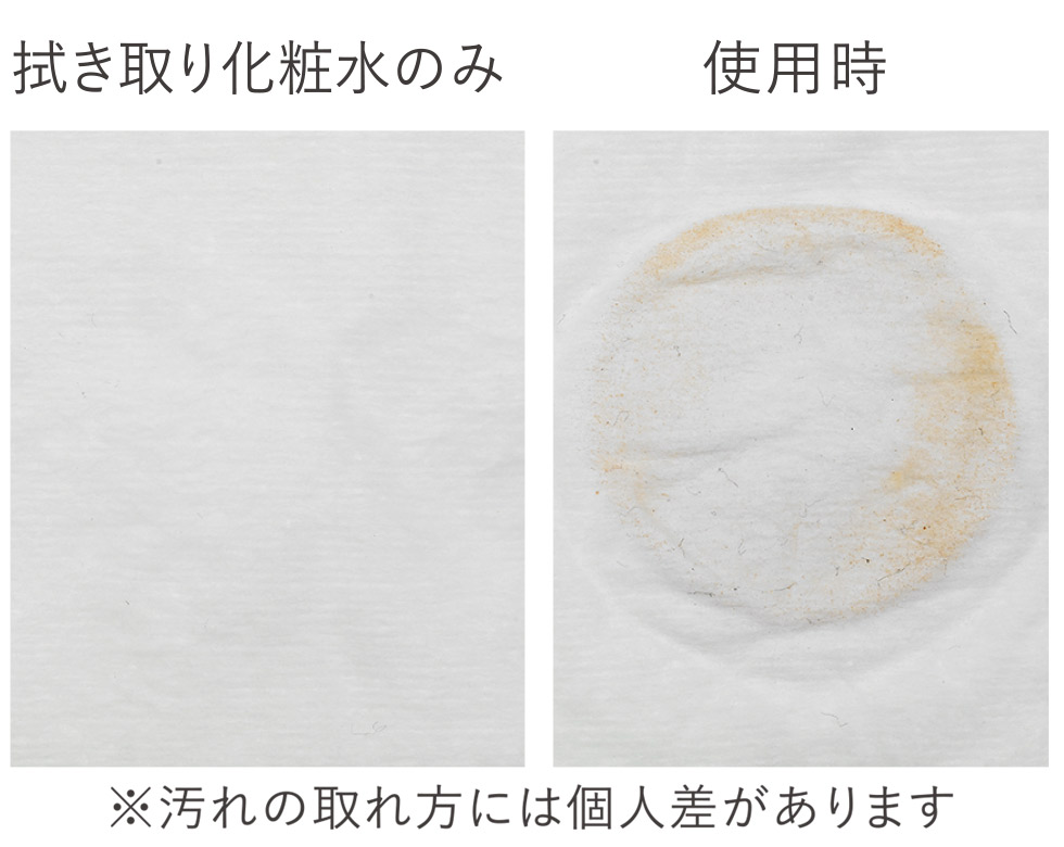 エナージュ 超音波美顔器 KBE-1130 温めながらクレンジング