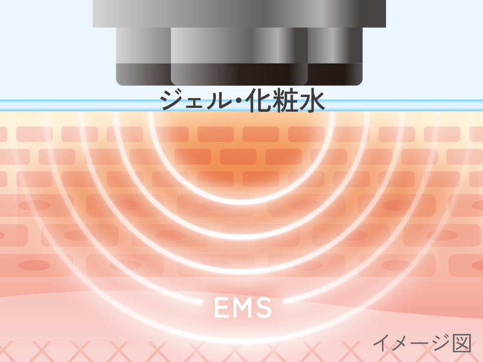 エナージュ　リフト美顔器RF　目元ケア　KBE-1140　RF+EMSモード