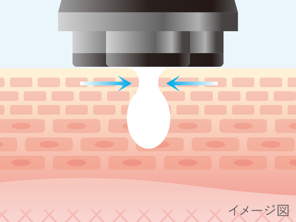エナージュ　リフト美顔器RF　目元ケア　KBE-1140　COOLモード