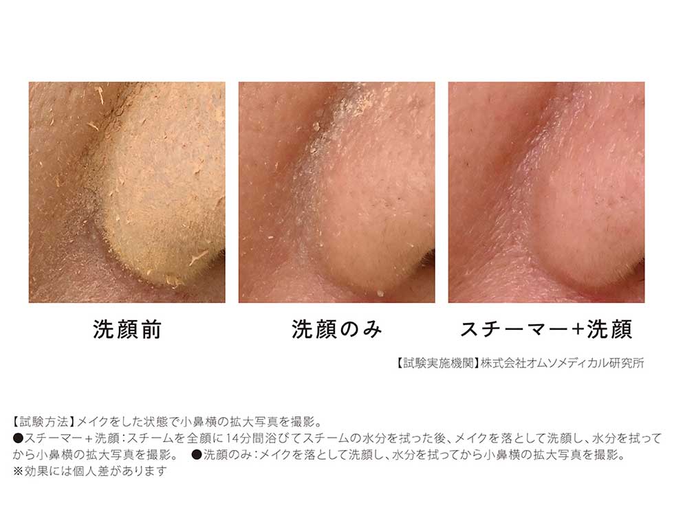 エナージュフェイススチーマーKBE-1530　ENAGE エナージュ　毛穴の汚れを洗浄