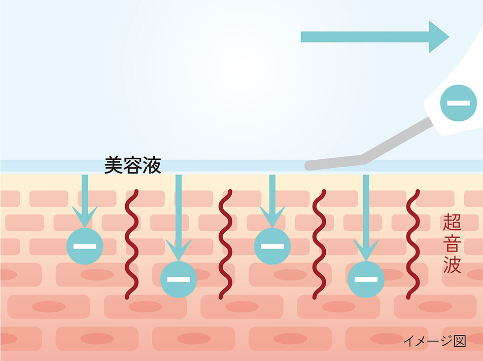 エナージュ ENAGE エステ 超音波ピーリング 美容成分を角質層まで浸透