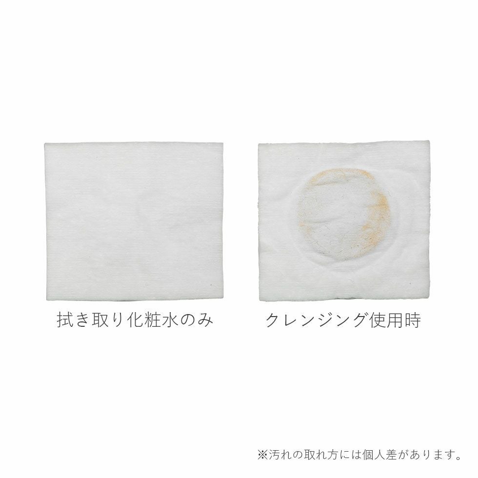 販売終了】エナージュ超音波美顔器KBE-1130 | コイズミオンラインショップ